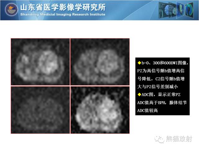 【PPT】盆腔影像检查技术及诊断的培训要点