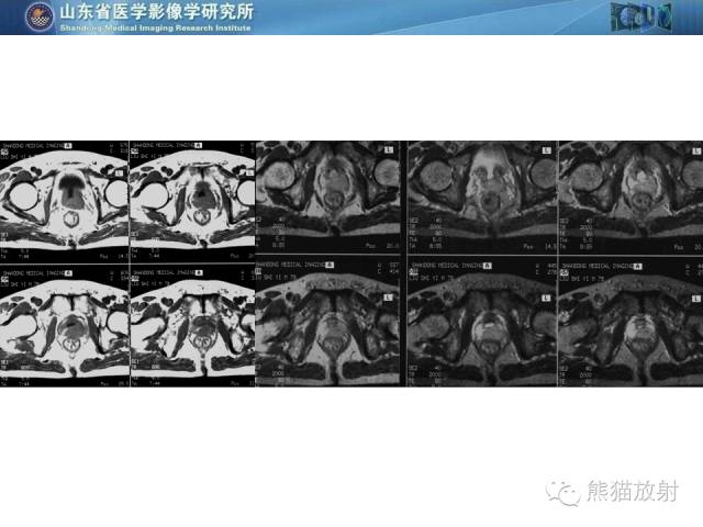 【PPT】盆腔影像检查技术及诊断的培训要点