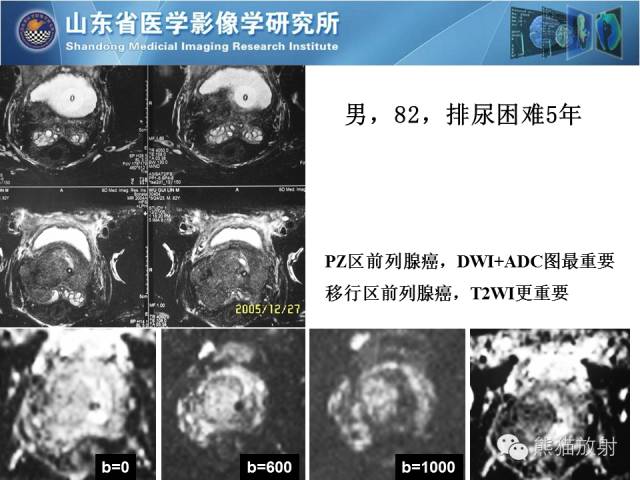 【PPT】盆腔影像检查技术及诊断的培训要点