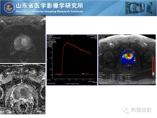 【PPT】盆腔影像检查技术及诊断的培训要点