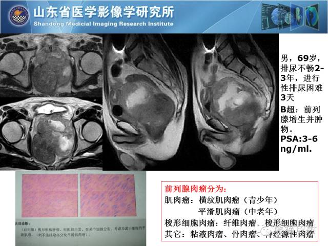 【PPT】盆腔影像检查技术及诊断的培训要点