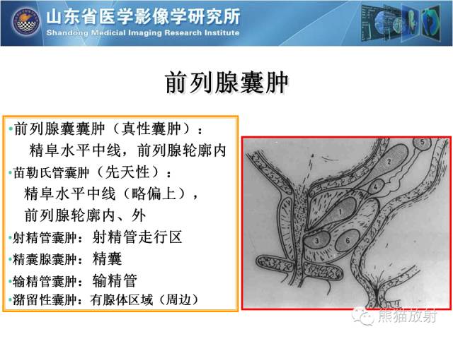 【PPT】盆腔影像检查技术及诊断的培训要点