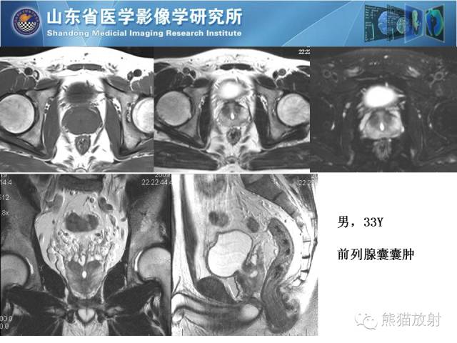 【PPT】盆腔影像检查技术及诊断的培训要点