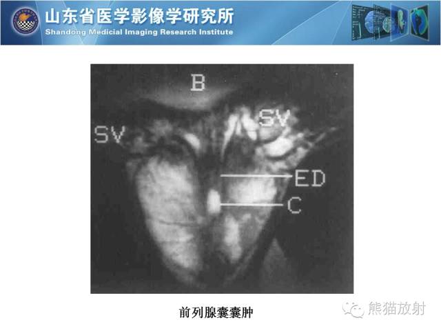 【PPT】盆腔影像检查技术及诊断的培训要点