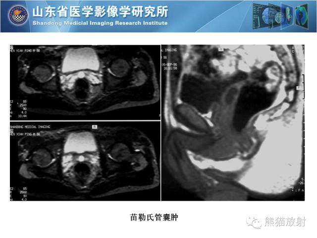 【PPT】盆腔影像检查技术及诊断的培训要点