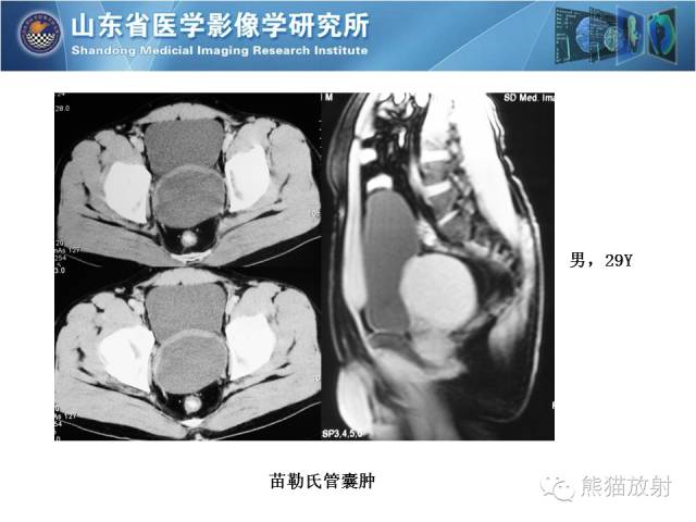 【PPT】盆腔影像检查技术及诊断的培训要点