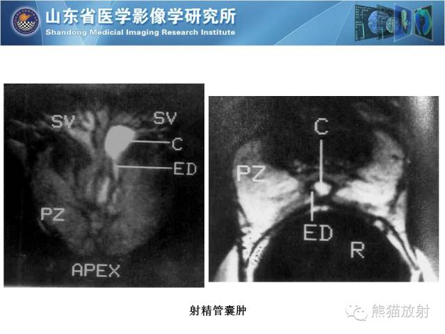 【PPT】盆腔影像检查技术及诊断的培训要点