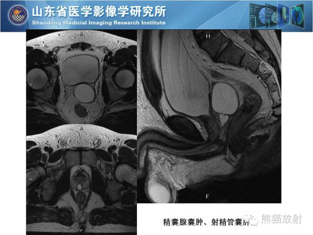 【PPT】盆腔影像检查技术及诊断的培训要点