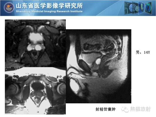 【PPT】盆腔影像检查技术及诊断的培训要点