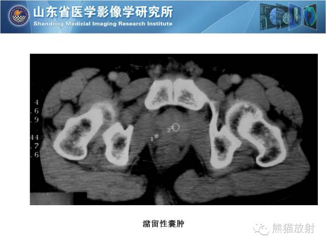【PPT】盆腔影像检查技术及诊断的培训要点