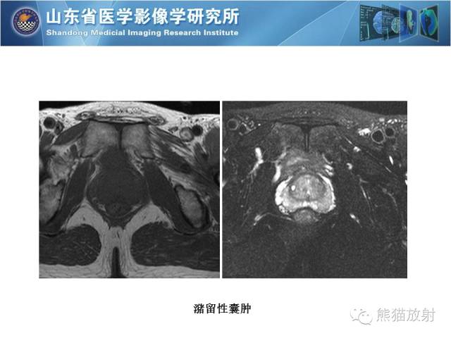 【PPT】盆腔影像检查技术及诊断的培训要点
