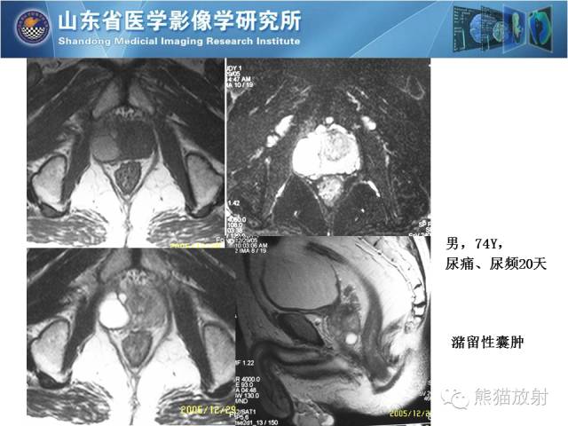 【PPT】盆腔影像检查技术及诊断的培训要点