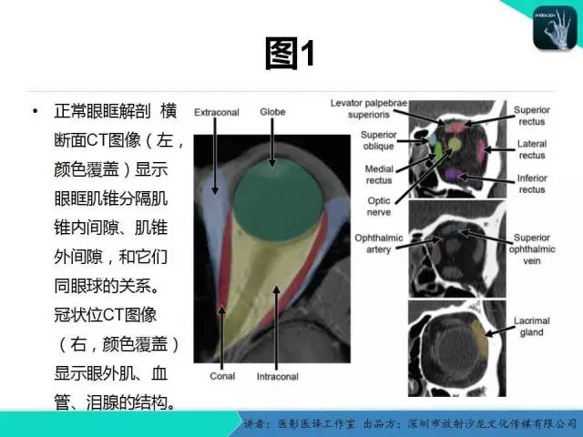 【PPT】成人眼眶肿瘤：临床、影像、与病理回顾