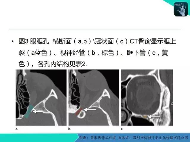 【PPT】成人眼眶肿瘤：临床、影像、与病理回顾