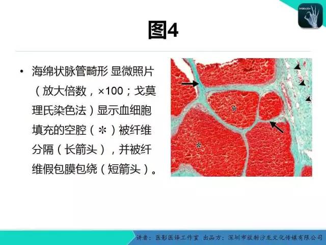 【PPT】成人眼眶肿瘤：临床、影像、与病理回顾