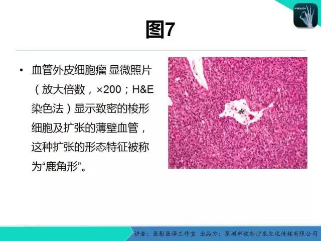 【PPT】成人眼眶肿瘤：临床、影像、与病理回顾