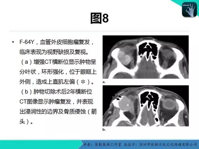 【PPT】成人眼眶肿瘤：临床、影像、与病理回顾