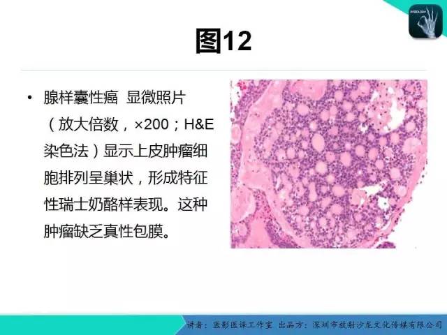 【PPT】成人眼眶肿瘤：临床、影像、与病理回顾