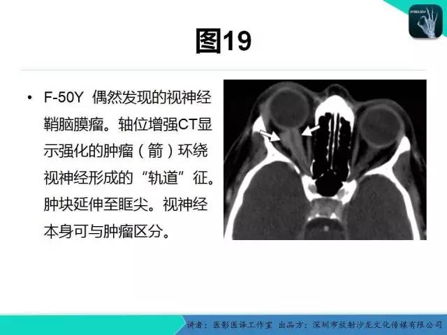 【PPT】成人眼眶肿瘤：临床、影像、与病理回顾