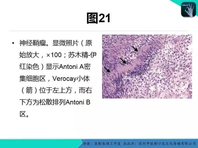 【PPT】成人眼眶肿瘤：临床、影像、与病理回顾