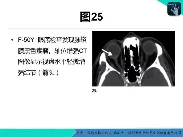 【PPT】成人眼眶肿瘤：临床、影像、与病理回顾