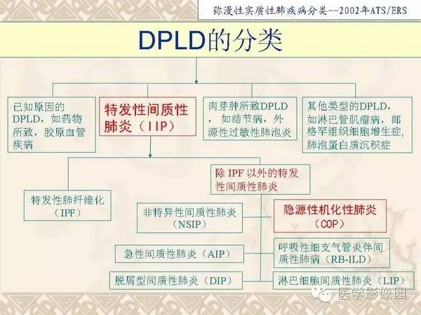 【PPT】隐源性机化性肺炎
