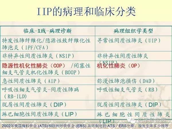 【PPT】隐源性机化性肺炎