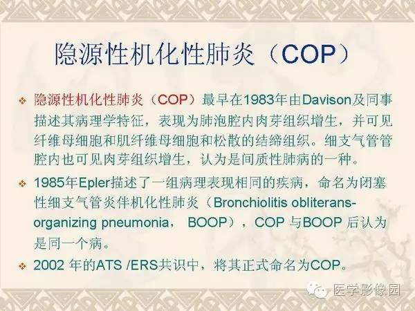 【PPT】隐源性机化性肺炎