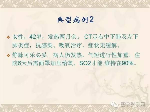 【PPT】隐源性机化性肺炎