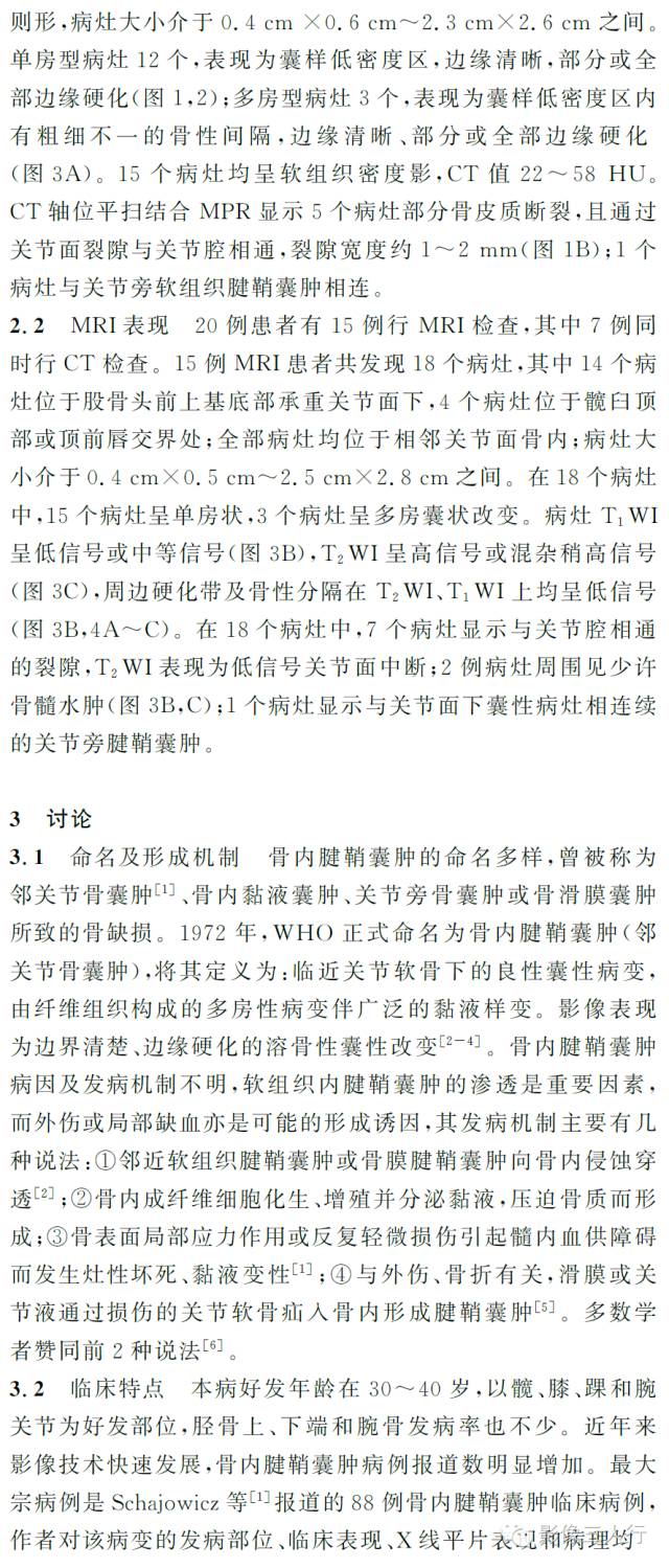 髋关节骨内腱鞘囊肿的CT及MRI影像学诊断 髋关节骨内腱鞘囊肿的CT及MRI影像学诊断