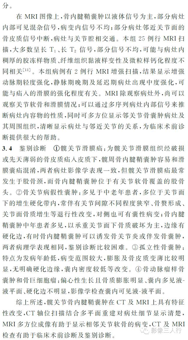 髋关节骨内腱鞘囊肿的CT及MRI影像学诊断 髋关节骨内腱鞘囊肿的CT及MRI影像学诊断