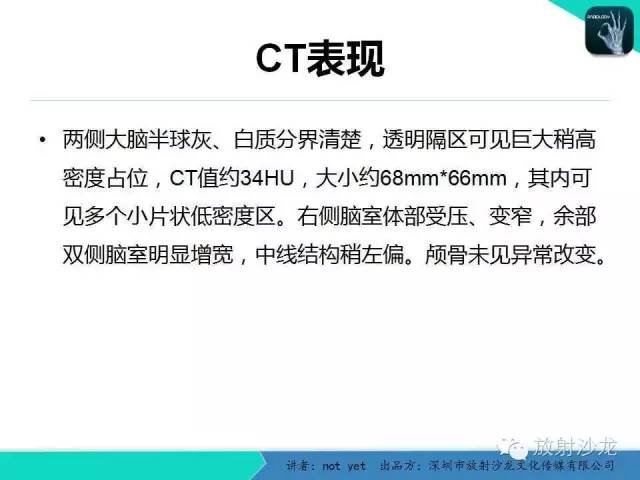 【病例】脑室内脑膜瘤1例CT及MR影像表现