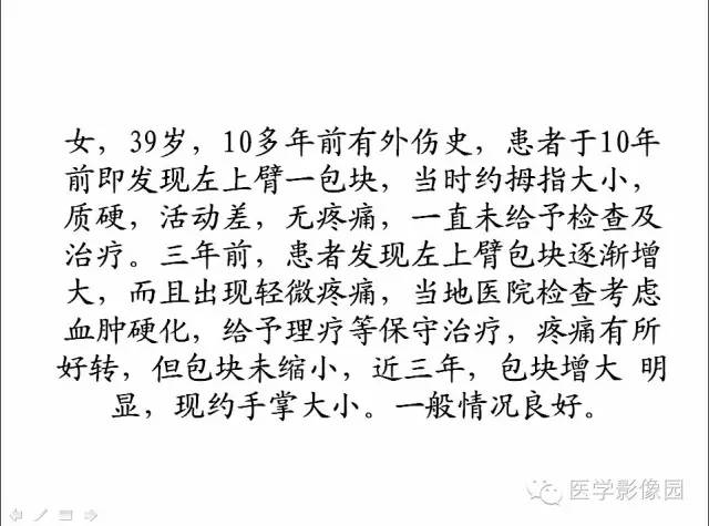【病例】（左上臂）腹壁外韧带样纤维瘤1例CT及MR