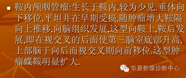 【病例】实性颅咽管瘤1例CT及MR影像表现 【病例】实性颅咽管瘤1例CT及MR影像表现