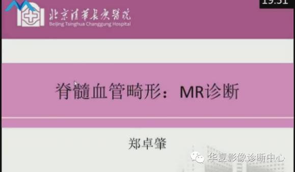 【PPT】脊髓血管畸形：MR诊断