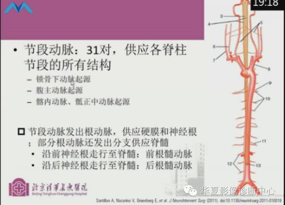 【PPT】脊髓血管畸形：MR诊断