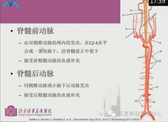 【PPT】脊髓血管畸形：MR诊断