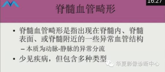 【PPT】脊髓血管畸形：MR诊断