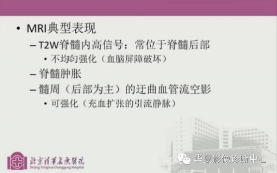 【PPT】脊髓血管畸形：MR诊断