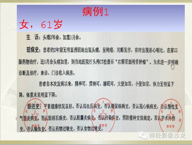 【病例】颅骨占位2例血管瘤VS脑膜瘤CT及MR鉴别诊断