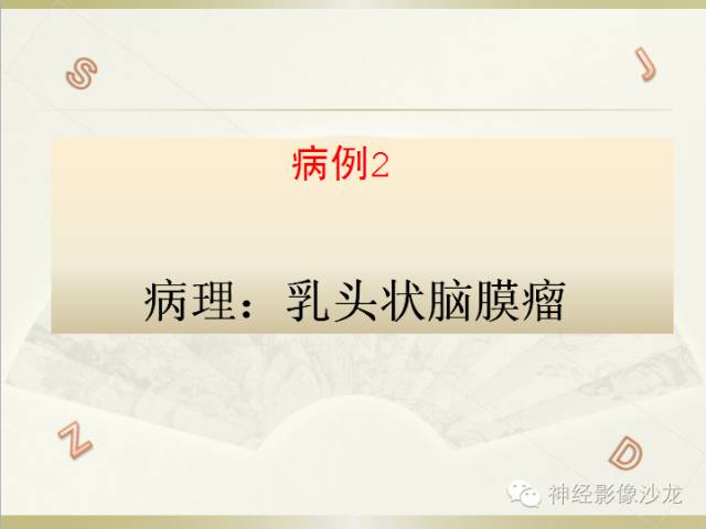 【病例】颅骨占位2例血管瘤VS脑膜瘤CT及MR鉴别诊断