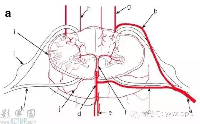 脊髓缺血综合征影像学评估