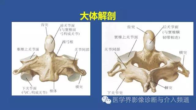 【PPT】颈椎骨折和脱位那些事