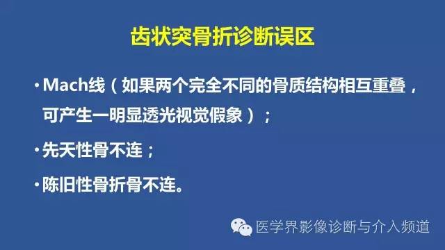 【PPT】颈椎骨折和脱位那些事