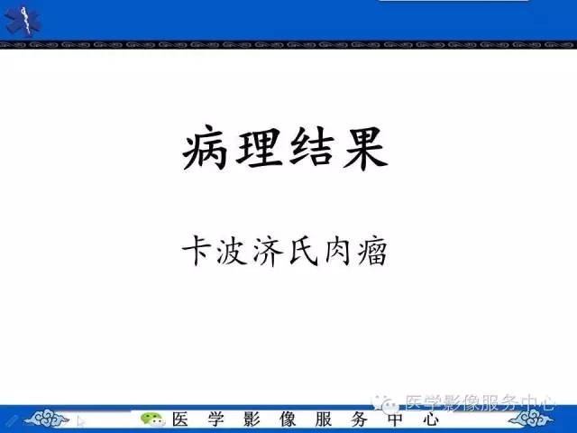 【病例】HIV引起的肺内多发病变——卡波济氏肉瘤1例CT