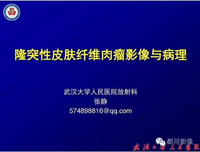 【病例】皮肤纤维肉瘤1例CT影像表现与鉴别