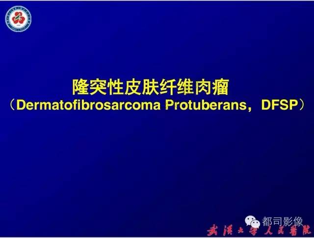 【病例】皮肤纤维肉瘤1例CT影像表现与鉴别