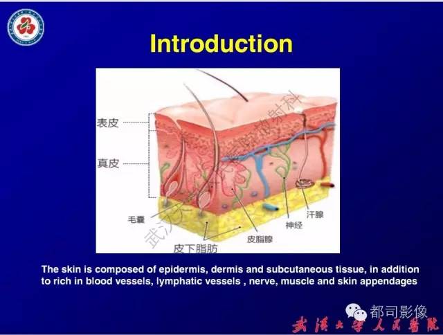 【病例】皮肤纤维肉瘤1例CT影像表现与鉴别