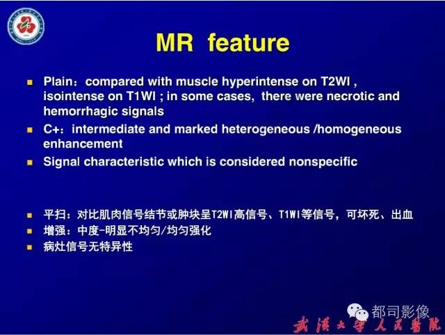 【病例】皮肤纤维肉瘤1例CT影像表现与鉴别
