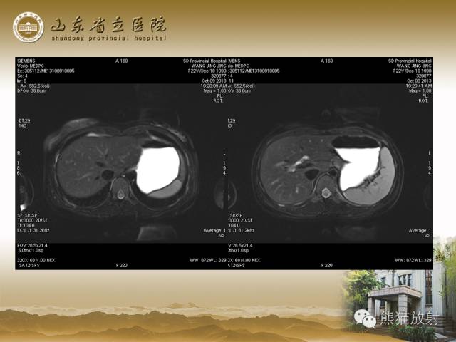 【PPT】肝脏影像学培训内容